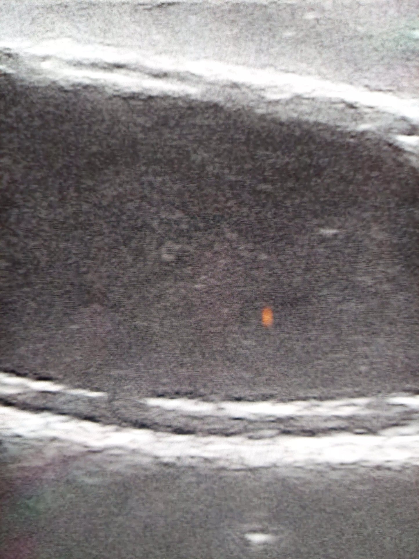 Ultraschalltrainer Hundeblase