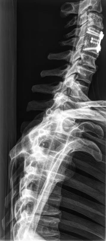 Erler-ZimmerGanzkörper RöntgenphantomDocMed GmbH