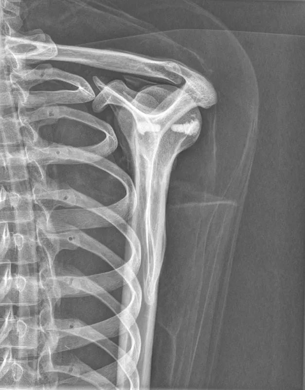 Erler - ZimmerGanzkörper RöntgenphantomDocMed GmbH