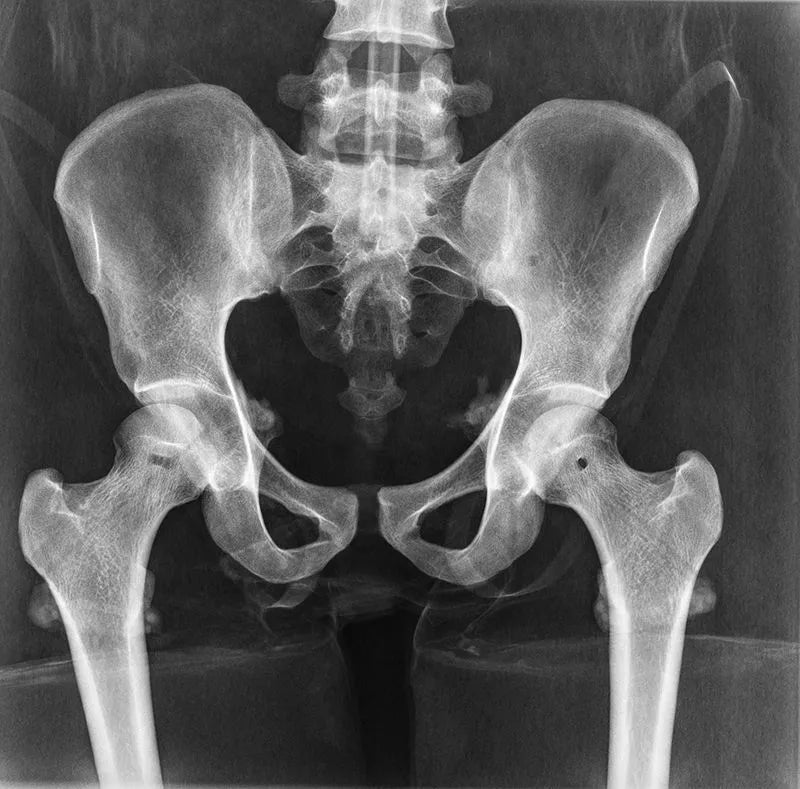 Erler - ZimmerGanzkörper RöntgenphantomDocMed GmbH