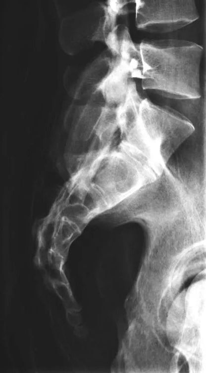 Erler - ZimmerGanzkörper RöntgenphantomDocMed GmbH