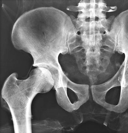 Erler - ZimmerGanzkörper RöntgenphantomDocMed GmbH