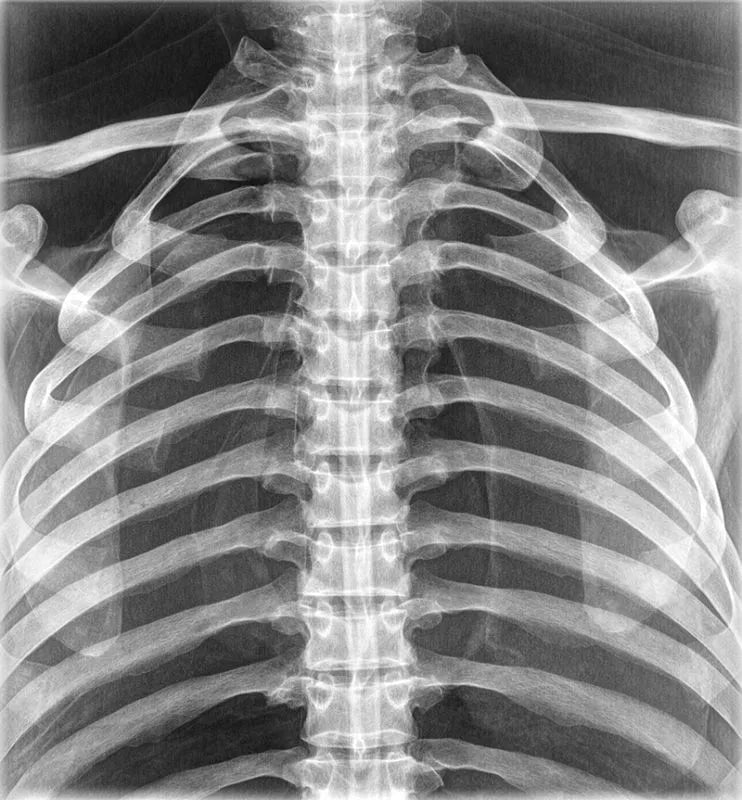 Erler - ZimmerGanzkörper RöntgenphantomDocMed GmbH