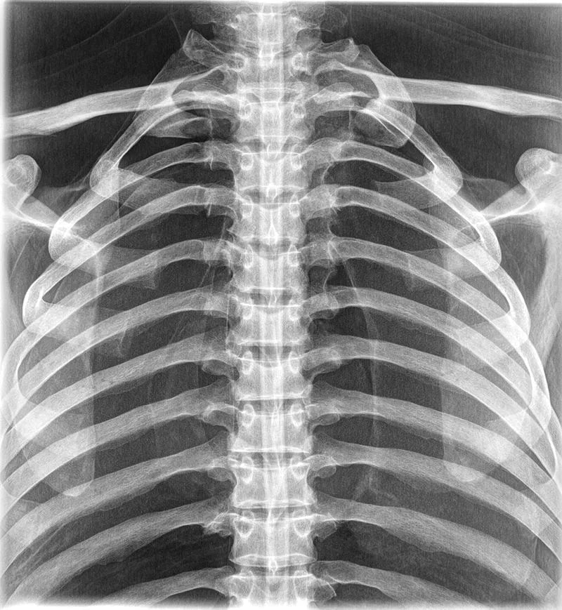 Erler-ZimmerRöntgen-ThoraxDocMed GmbH