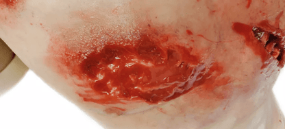 Erler-ZimmerTrauma Training TorsoDocMed GmbH