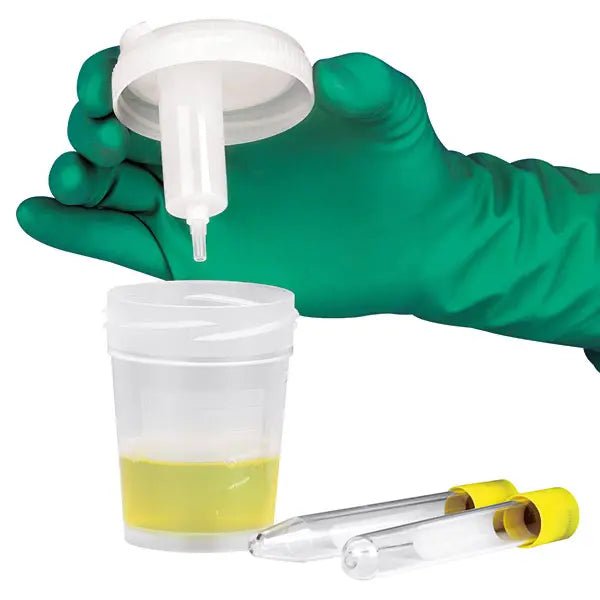 Kima S.r.l.Urinsammelsystem mit SicherheitsfunktionDocMed GmbH