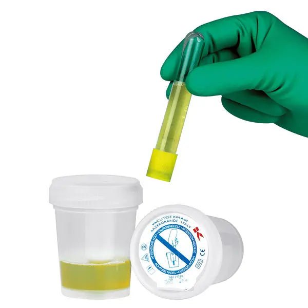 Kima S.r.l.Urinsammelsystem mit SicherheitsfunktionDocMed GmbH